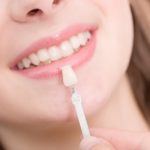 matching color for a dental crown