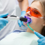 professional teeth whitening