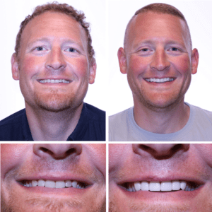 Northcutt Dental Your Guide To A Healthy Confident Smile - lpl06az