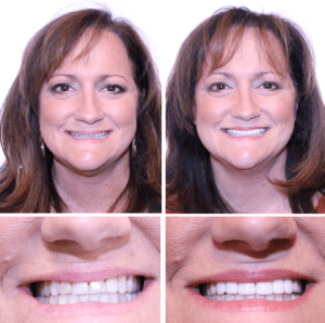 Northcutt Dental Your Guide To A Healthy Confident Smile - 7gjxzt1