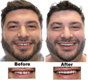 Northcutt Dental The Secret To A Hollywood Smile - 2izc46j