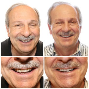 Northcutt Dental The Secret To A Hollywood Smile - nwdvdmi